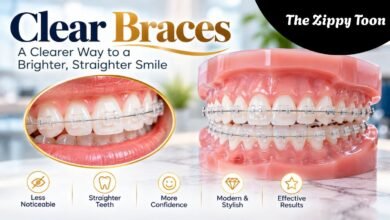 Clear Braces